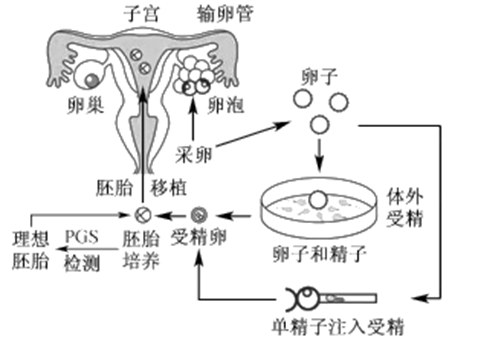 试管婴儿费用