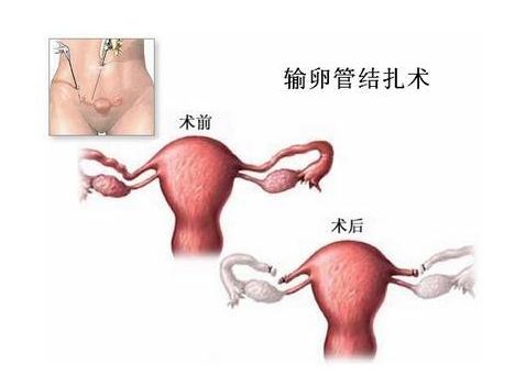 卵子质量